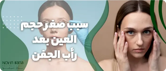 صغر حجم العين بعد رأب الجفن